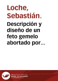 Descripción y diseño de un feto gemelo abortado por una mujer en Barcelona en el año 1774, que regala don Antonio de Gimbernat al gabinete del colegio  [Manuscrito] / por Sebastian Loche | Biblioteca Virtual Miguel de Cervantes